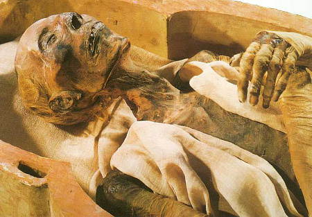 A múmia segíti a prosztatitist